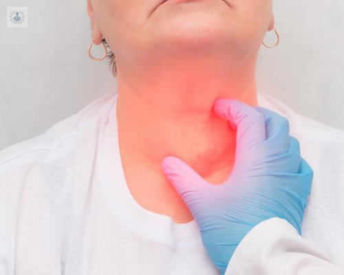 el-bocio-simple imagen de artículo