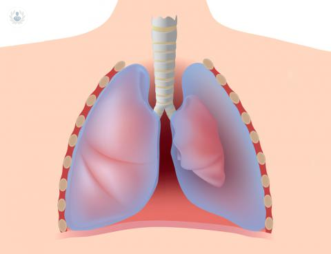 las-claves-del-neumotorax imagen de artículo