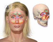 que-es-la-sinusitis-y-como-tratarla imagen de artículo