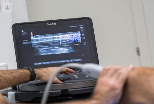 teg-terapia-ecoguiada-lo-ultimo-en-el-tratamiento-de-lesiones-de-partes-blandas imagen de artículo