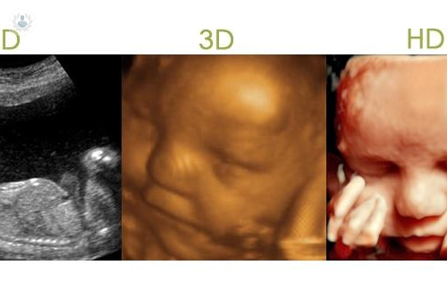 diferencias-entre-la-ecografia-2d-3d-y-4d imagen de artículo