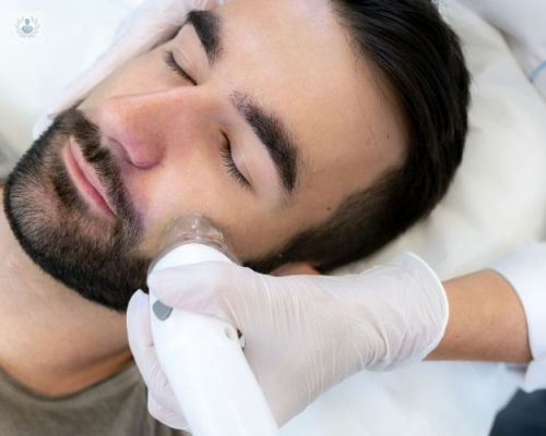 lifting-facial-con-radiofrecuencia-e-hilos-tensores imagen de artículo