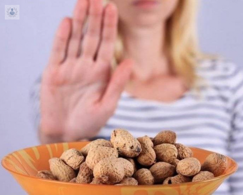 intolerancia-e-histaminosis-alimentaria-que-son-y-como-se-debe-actuar imagen de artículo