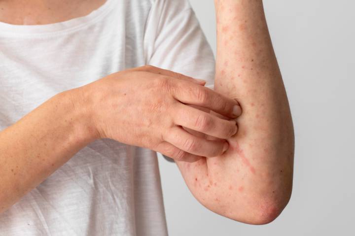 como-se-diagnostican-las-enfermedades-dermatologicas imagen de artículo