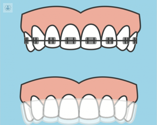 Ortodoncia para crear sonrisas