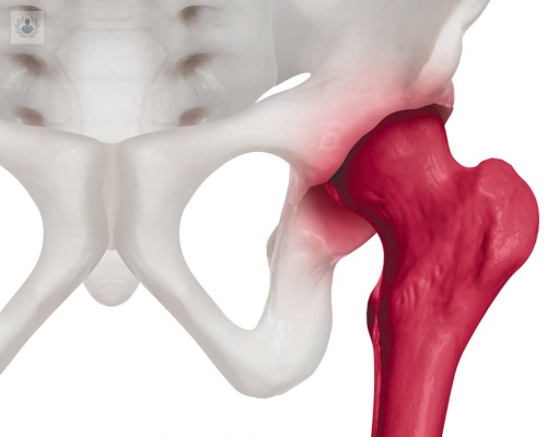 artrosis-la-primera-causa-de-incapacidad-en-personas-mayores imagen de artículo