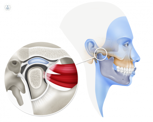 Tratamiento del Síndrome Disfunción Articular Temporomandibular (ATM) y de Dolor Orofacial