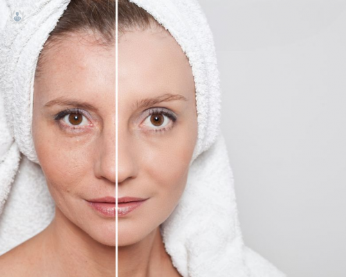 rejuvenecer-el-rostro-de-forma-natural-y-progresiva imagen de artículo