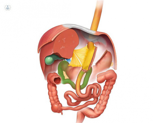 Bypass Gastroileal: una operación para adelgazar comiendo normal