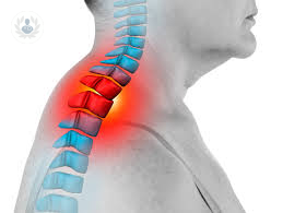 espondilitis-una-enfermedad-frecuente-en-varones-menores-de-30-anos imagen de artículo