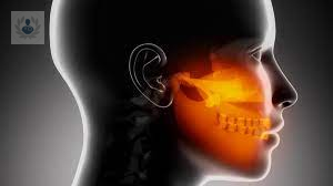 el-molesto-trastorno-de-la-articulacion-temporomandibular imagen de artículo