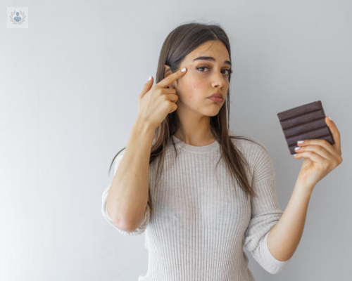 comer-chocolate-empeora-el-acne imagen de artículo