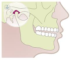 como-tratar-los-problemas-en-la-mandibula imagen de artículo