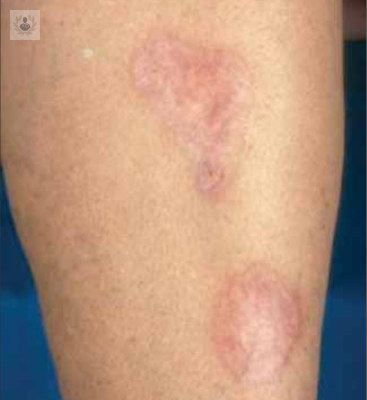 patologia-cutanea-en-el-navegante imagen de artículo