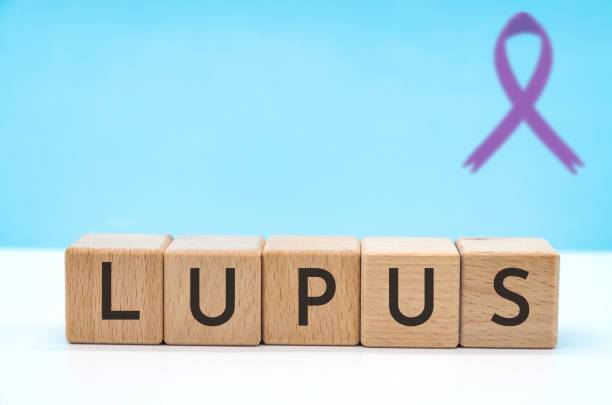 lupus-padecimiento-comun-en-mujeres imagen de artículo