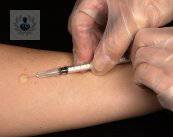 tuberculosis-pulmonar-infeccion-comun-y-contagiosa imagen de artículo