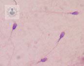 infertilidad-masculina-estudios-diagnosticos-y-opciones-de-tratamiento imagen de artículo