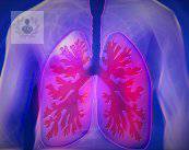 derrame-pleural-signos-de-alarma-y-causas-parte-1 imagen de artículo