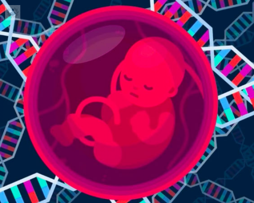 sindrome-dismorfico-caracteristicas-fisicas-poco-frecuentes imagen de artículo