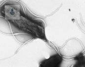 Helicobacter Pylori: bacteria resistente a los tratamientos