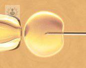 inseminacion-artificial-tratamiento-de-reproduccion-asistida-de-baja-complejidad imagen de artículo
