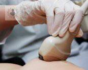 ecografia-mamaria-cuando-debe-hacerse imagen de artículo