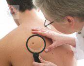 Rayos ultravioleta: daños que produce en la piel