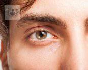 astigmatismo-principal-problema-de-desenfoque-del-ojo imagen de artículo