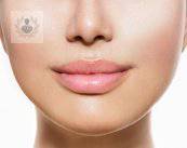 Lip augmentation, effective procedure and lasting