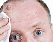 hiperhidrosis-y-sus-afecciones-emocionales imagen de artículo