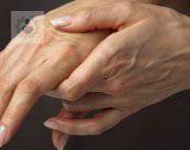 artritis-reumatoide-enfermedad-autoinmune-de-predisposicion-genetica imagen de artículo
