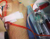 linfoma-de-hodgkin-causas-y-tratamiento imagen de artículo