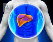 Hepatitis crónica: inflamación persistente del hígado