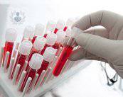 mieloma-multiple-diagnostico-parte-2 imagen de artículo