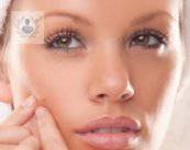 Cómo quitar el acné con tratamiento dermatológico
