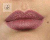 cancer-bucal-epidemiologia-y-factores-de-riesgo-p1 imagen de artículo