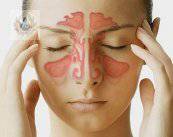 Sinusitis: inflamación nasal de origen diverso (P2)