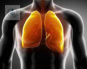 Neumonía: insuficiencia respiratoria aguda (P1)
