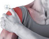 Tendinitis, manguito rotador y lesiones comunes del hombro (P1)