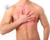Ginecomastia: procedimiento de reducción mamaria en hombres