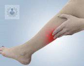 trombosis-obstruccion-arterial-o-venosa imagen de artículo