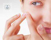 hemangioma-que-es imagen de artículo