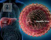 Hepatitis C: infección viral de transmisión sanguínea