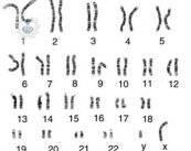Estudios cariotipo: diagnóstico de alteraciones cromosómicas