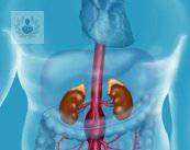 aneurisma-aortico-abdominal-agrandamiento-de-la-aorta imagen de artículo