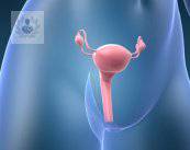 Histerectomía, operación para tratar problemas uterinos