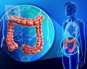 ¿Cómo prevenir el cáncer de colon? (Parte 1)