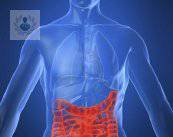 prevencion-del-cancer-de-colon-parte-2 imagen de artículo