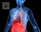 Trauma abdominal o contusión abdominal: cómo detectarla a tiempo (P2)