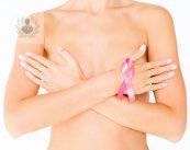 Breast cancer: can it be cured?